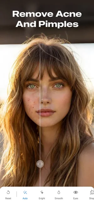 Before-and-after split showing acne and blemishes removed from a face
